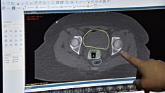 Ekranda rahim ağzı kanserini işaret eden bir doktor (arşiv)