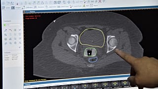 Ekranda rahim ağzı kanserini işaret eden bir doktor (arşiv)