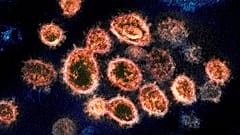 Gegen das SARS-CoV2-Virus und seine Verbreitung im Körper soll die neue Pille von Pfizer helfen