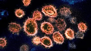 Европейские больницы готовятся к наплыву пациентов с COVID-19