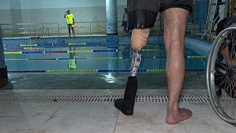 Palestinian with an amputated limb standing by the pool.