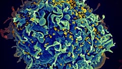 HIV virüsü saldırısı altındaki bir T-hücresi