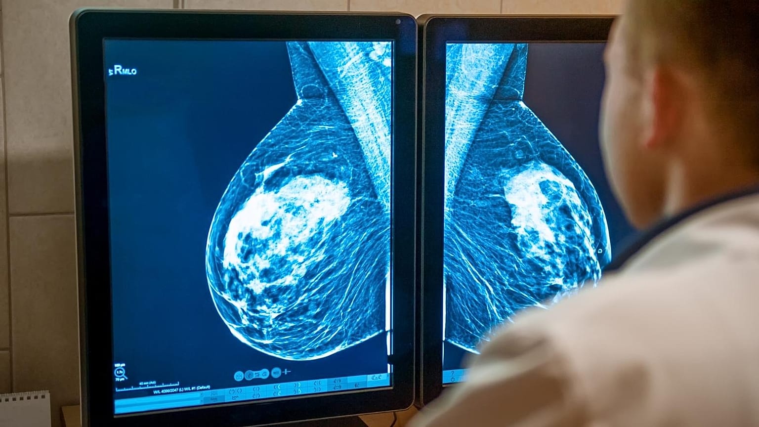 Cancer care has been severely impacted across Europe because of the COVID pandemic.