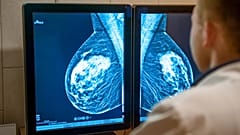 Cancer care has been severely impacted across Europe because of the COVID pandemic.