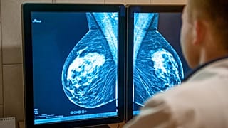 Cancer care has been severely impacted across Europe because of the COVID pandemic.