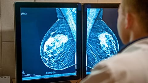 Cancer care has been severely impacted across Europe because of the COVID pandemic.