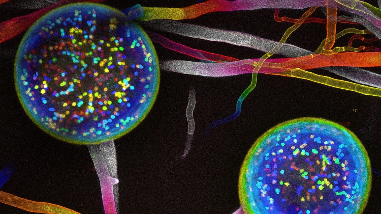 Fungal networks are being mapped for the first time. Image shows the reproductive spores containing nuceli.