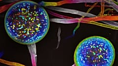 Fungal networks are being mapped for the first time. Image shows the reproductive spores containing nuceli.