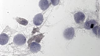 Covid-19 sperm kalitesini etkiliyor