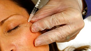Injektion von Botox - ARCHIV