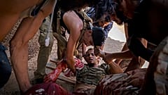 مقاتل مصاب بعد إطلاق النار عليه في طرابلس، ليبيا.
