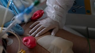 وحدة العناية المركزة في مستشفى لا تيمون في مرسيليا، جنوب فرنسا.