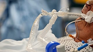 Пациент на ИВЛ в одной из больниц Вестерштеде, Германия