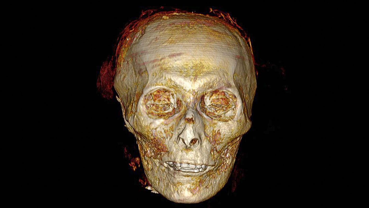 Le crane d'Amenhotep Ier se révélant grâce à l'imagerie médicale