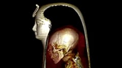 CT scan and X-ray images show inside the wrappings of Pharaoh Amenhotep's mummy