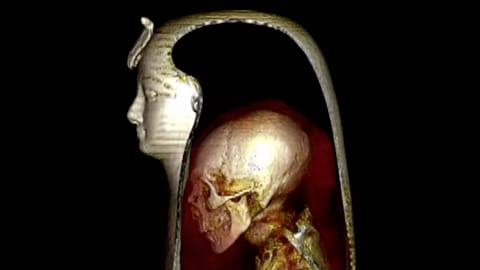CT scan and X-ray images show inside the wrappings of Pharaoh Amenhotep's mummy