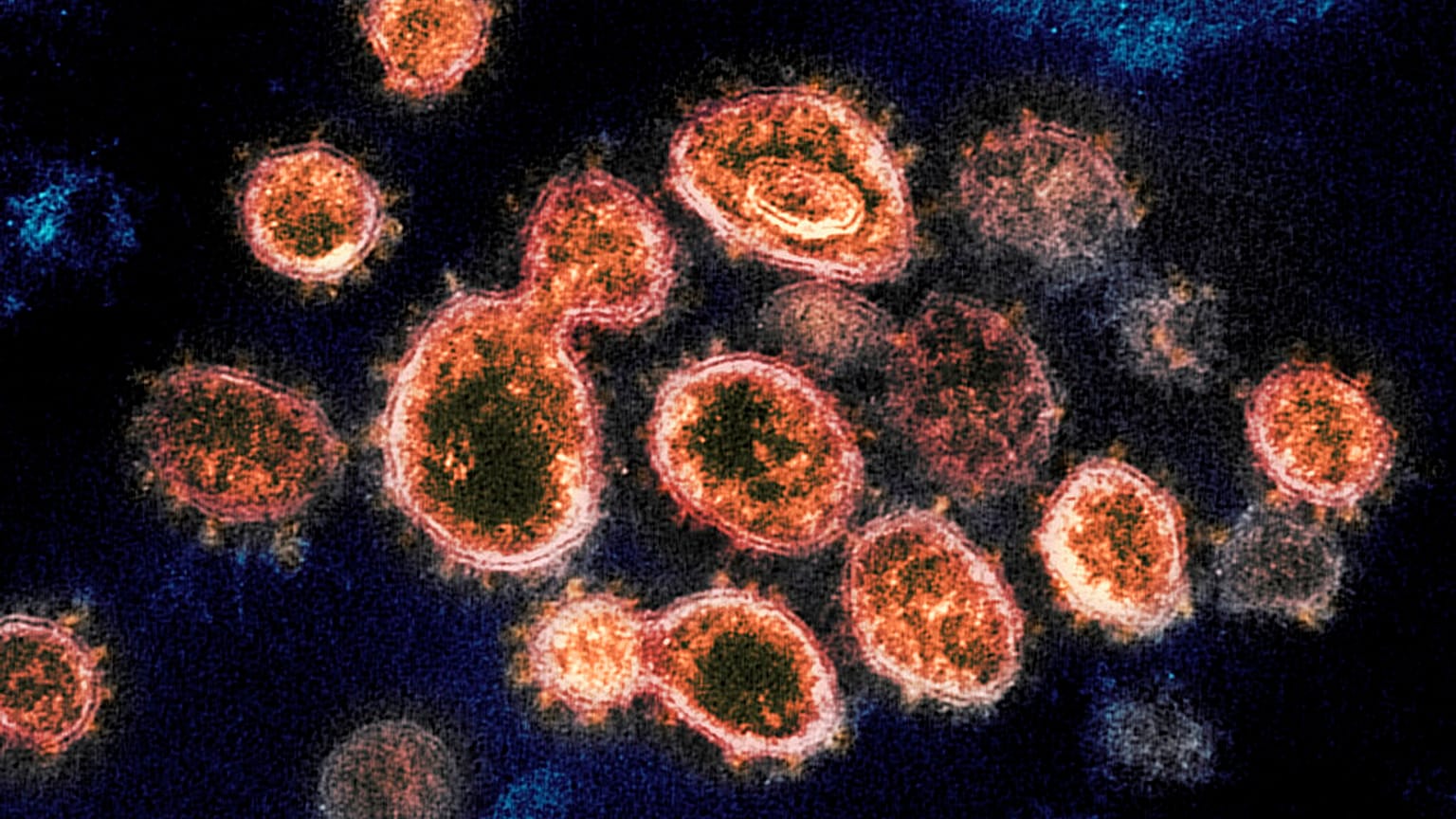 Le virus SARS-CoV-2 (image microscope de 2020)