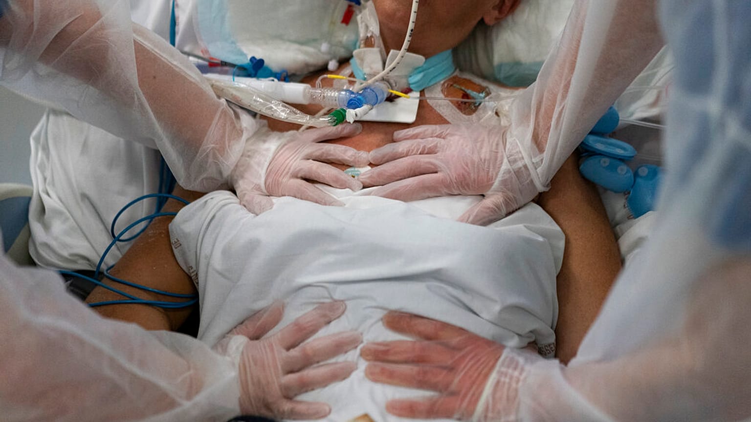 Behandlung einer Covid-Patientin in Marseille: Die Krankenhäuser in der Region sind an der Belastungsgrenze, Patient:innen werden in andere Regionen verlegt.