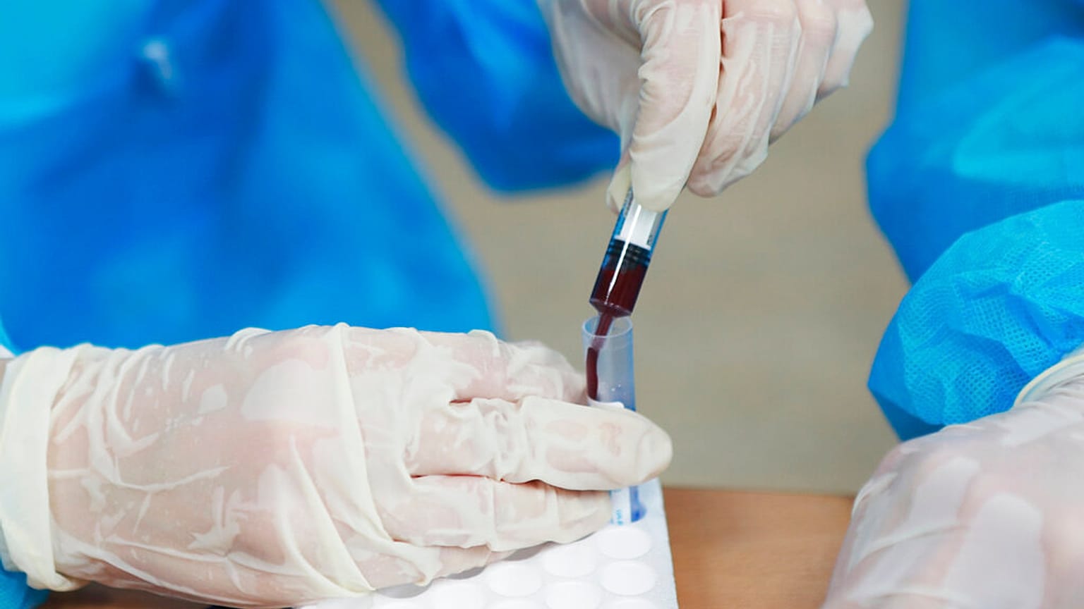 Kan testleri kanserin erkenden teşhisine yardımcı olabilecek