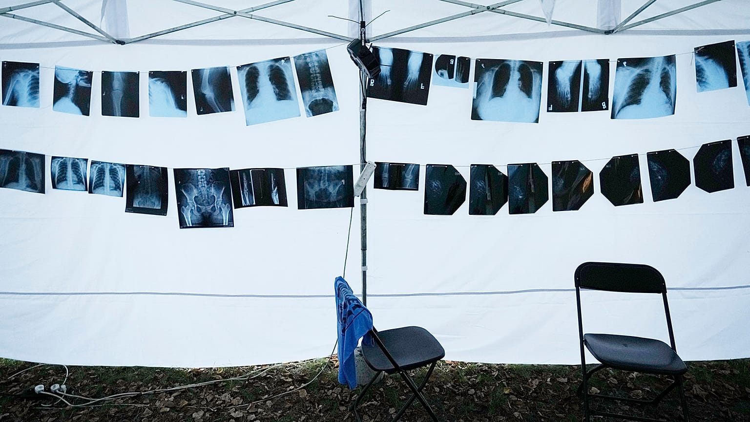  X-rays hang in a tent that is part of a protest camp in Warsaw, Poland