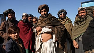 Afganistan'da geçinmek için böbreğini satmak zorunda kalan Sardar Muhammad