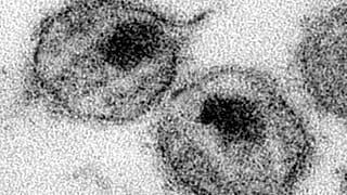 HIV'in elektron mikroskobu görüntüsü (Arşiv)