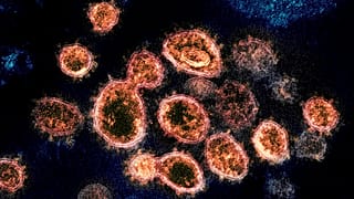 une image au microscope électronique montrant des particules du virus SRAS-CoV-2 à l'origine du COVID-19,