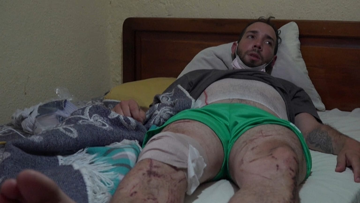 Franz Hernández se recupera tras ser arrollado por el aluvión de Quito. 