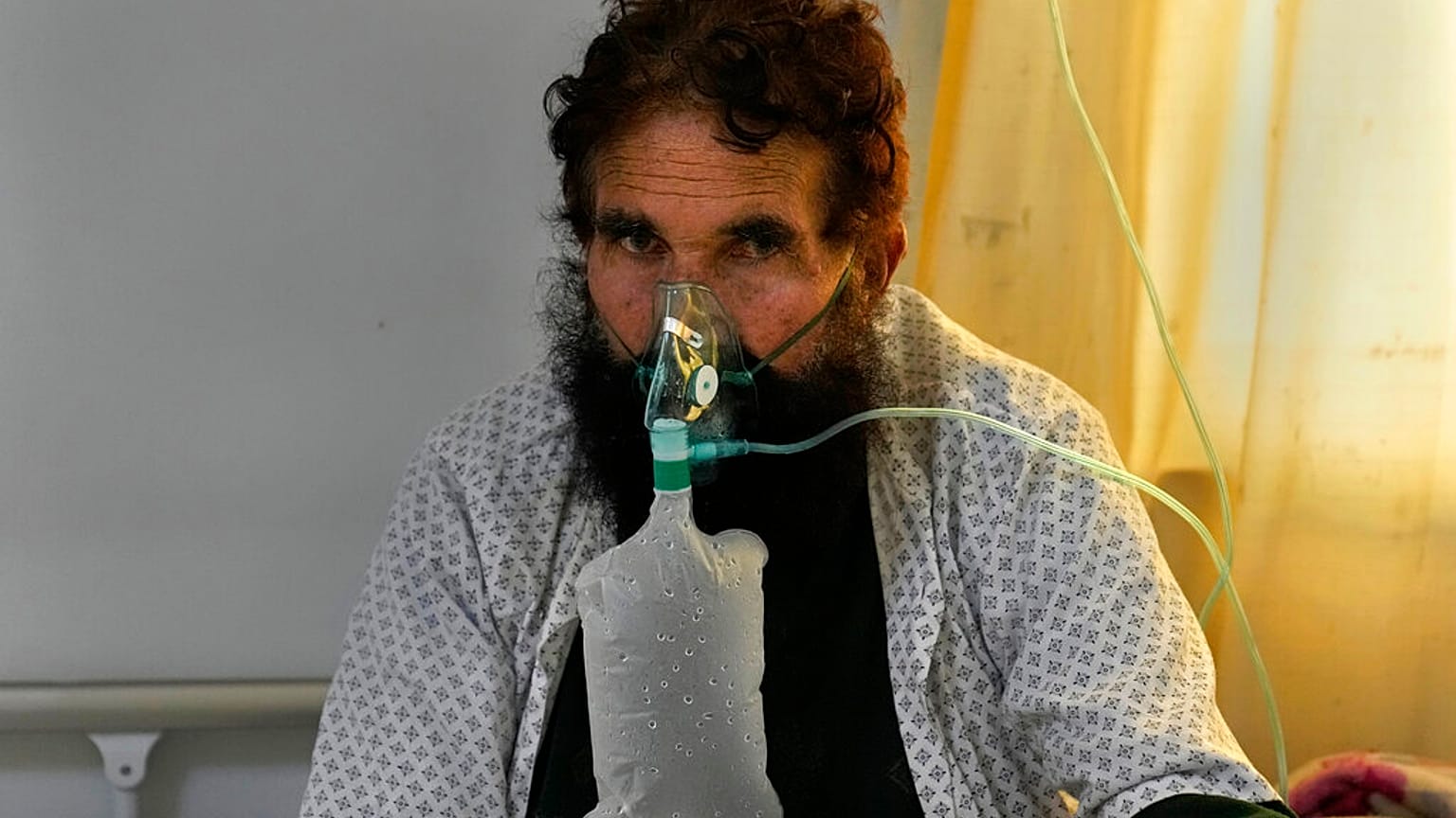 Un patient afghan infecté par le Covid-19 dans l'unité de soins intensifs d'un hôpital de Kaboul (Afghanistan), lundi 7 février 2022. 