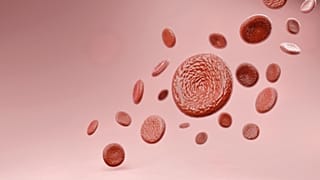 The woman has been virus-free for 14 months after receiving stem cell treatment for leukaemia from a HIV-resistant blood donor.