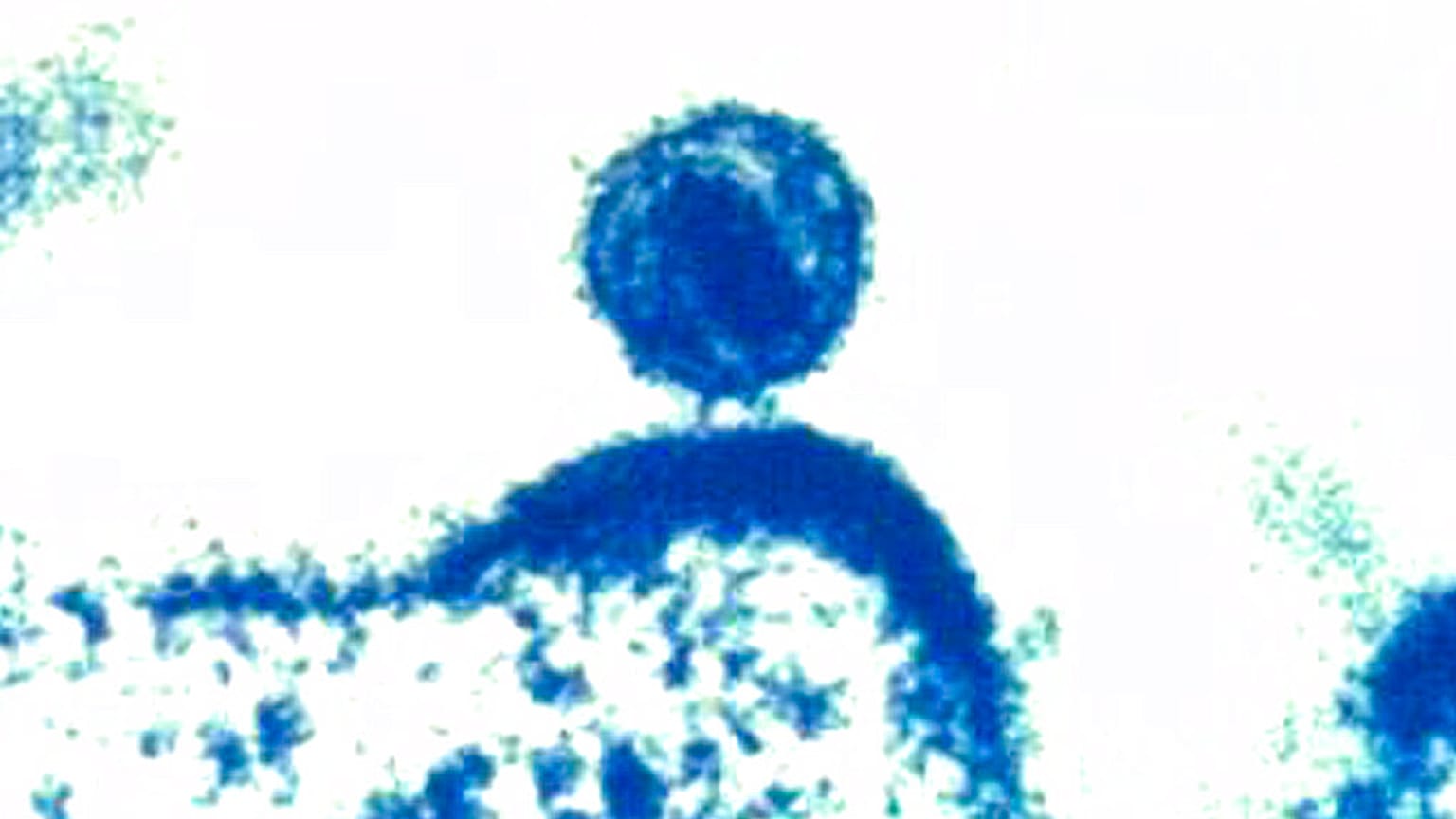 Elektronenmikroskopisches Bild eines menschlichen Immundefizienz-Virus vom National Institute of Allergy and Infectious Diseases (2012)