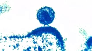 Elektronenmikroskopisches Bild eines menschlichen Immundefizienz-Virus vom National Institute of Allergy and Infectious Diseases (2012)