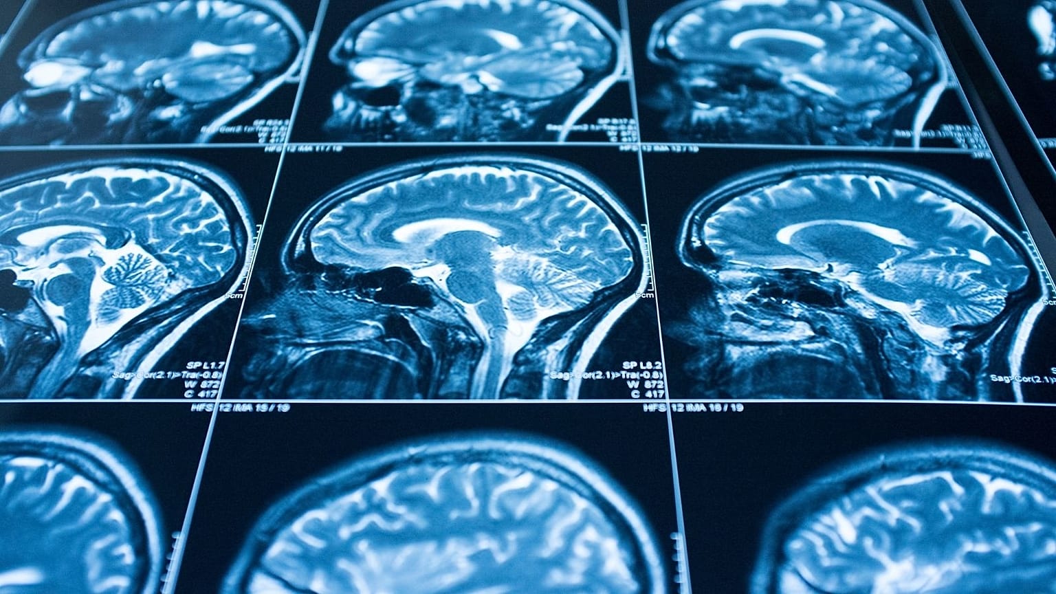Reports of people’s lives flashing before their eyes when they have a near-death experience have long-puzzled neuroscientists. 