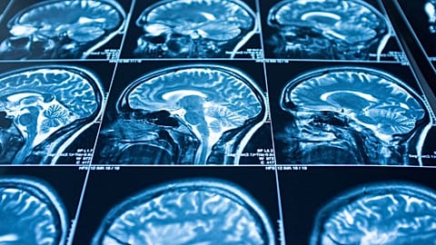Reports of people’s lives flashing before their eyes when they have a near-death experience have long-puzzled neuroscientists. 