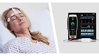 Agyfunkciót monitorozó orvosi műszer