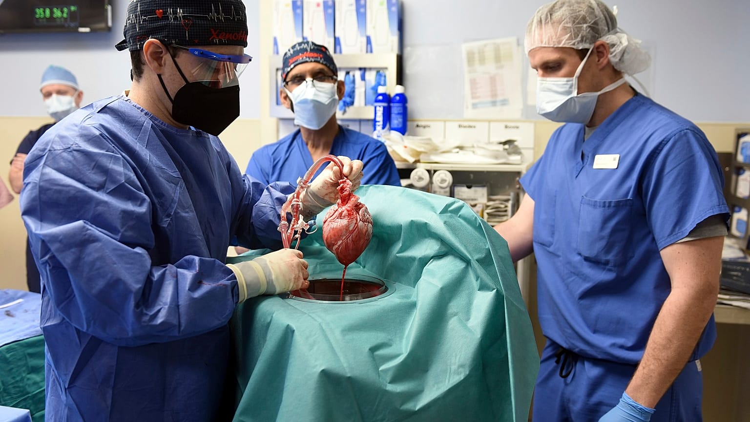 Doctors at the University of Maryland School of Medicine carry out the world's first pig-to-human heart transplant.
