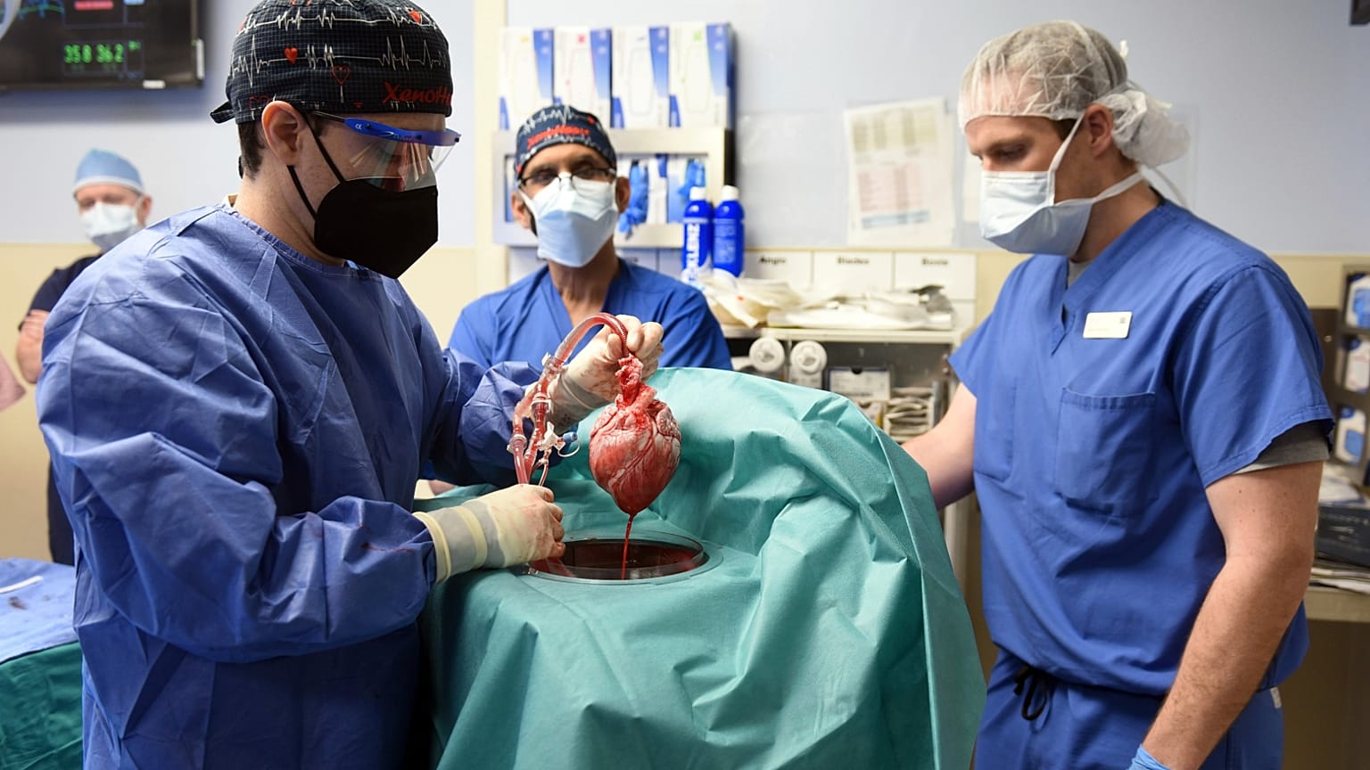 Archives : le cœur de cochon avant d'être greffé sur le patient, le 7 janvier 2022, par les équipes de l'école de médecine de l'Université du Maryland aux Etats-Unis