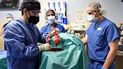 Archives : le cœur de cochon avant d'être greffé sur le patient, le 7 janvier 2022, par les équipes de l'école de médecine de l'Université du Maryland aux Etats-Unis