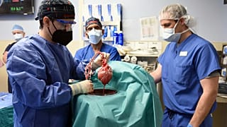 Archives : le cœur de cochon avant d'être greffé sur le patient, le 7 janvier 2022, par les équipes de l'école de médecine de l'Université du Maryland aux Etats-Unis