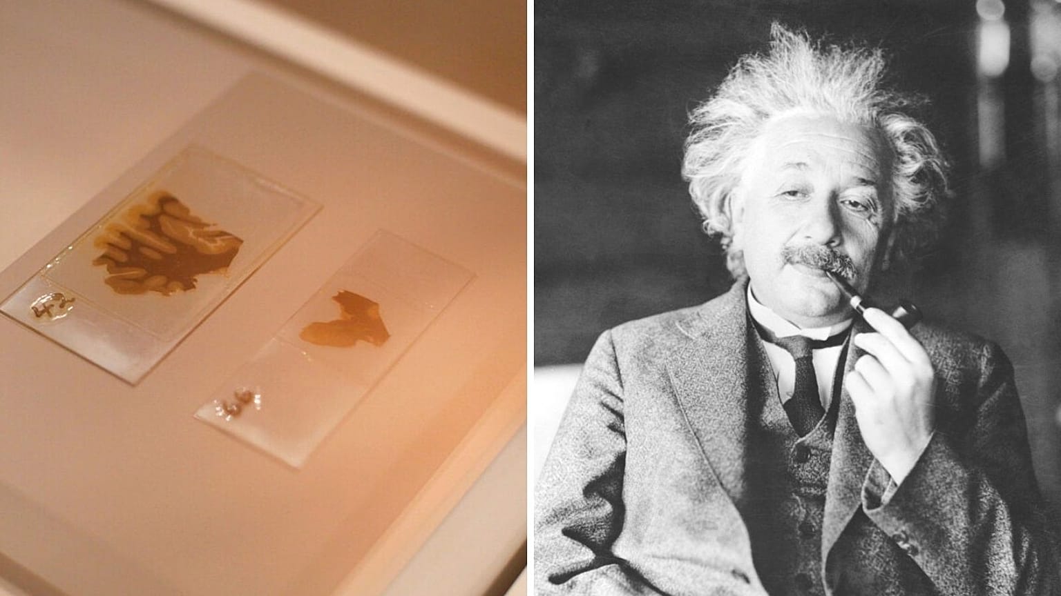 Albert Einstein's brain