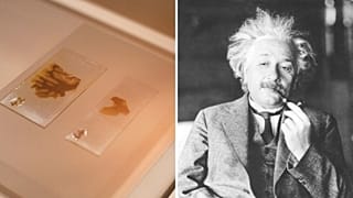 Albert Einstein's brain