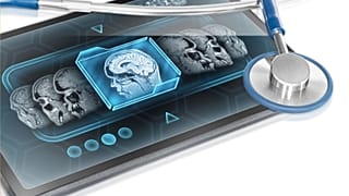 تاثیرات کووید بر روی مغز