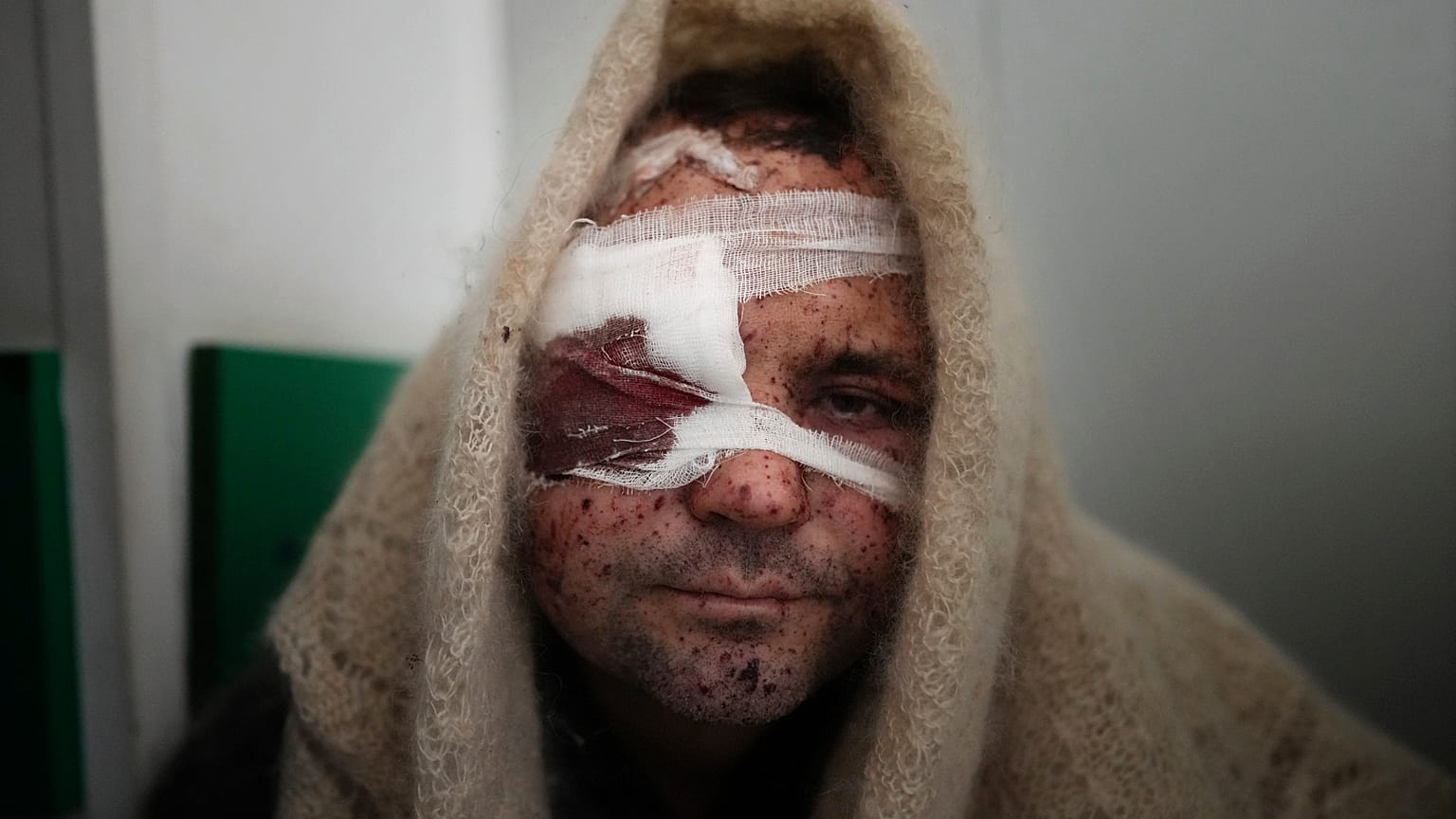 Un blessé à l'hôpital de Marioupol, le 11 mars