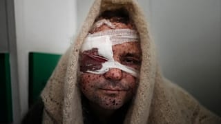 Un blessé à l'hôpital de Marioupol, le 11 mars