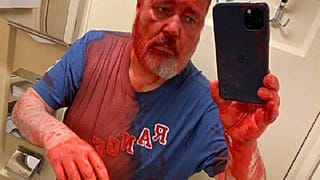 Дмитрий Муратов после нападения в поезде