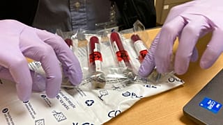 Cancer Blood Test