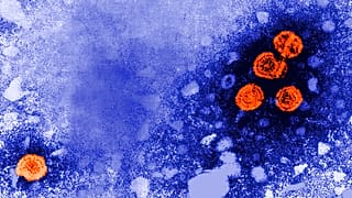 Hepatitis vírus