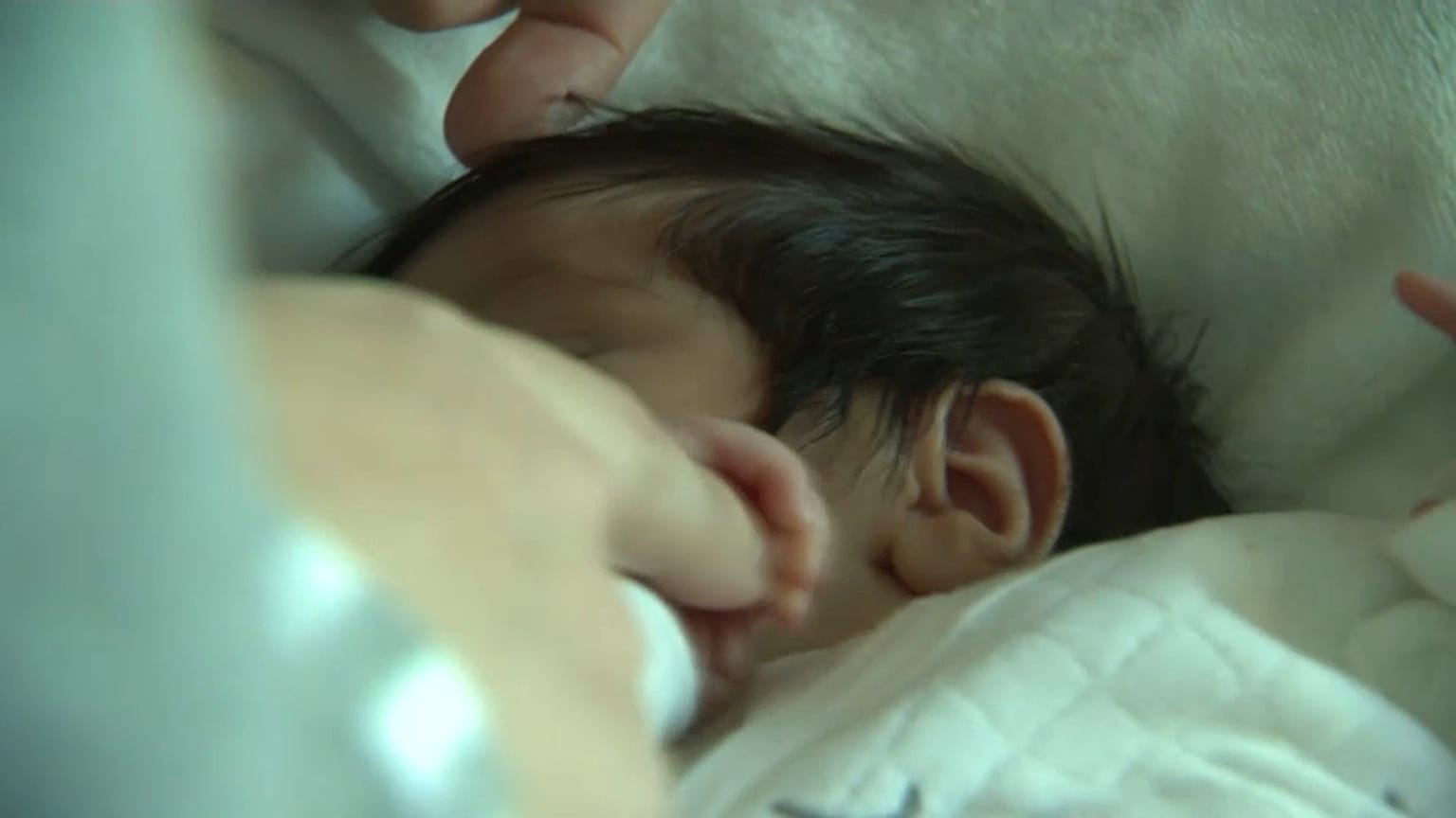 An Hepatitis erkranktes Baby