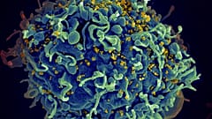 صورة مجهرية إلكترونية لخلية تائية بشرية، مشار إليها باللون الأزرق، تتعرض لهجوم من قبل فيروس نقص المناعة البشرية