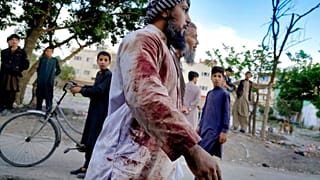 Un fidèle afghan ensanglanté près de la mosquée où a eu lieu l'explosion, à Kaboul, en Afghanistan, vendredi 29 avril 2022.